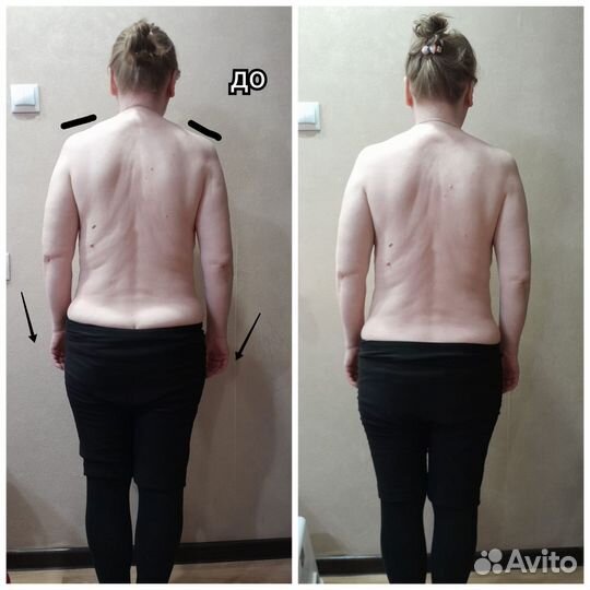 Остеопатия, телесные практики