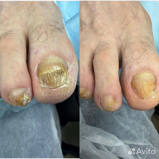 Педикюр с выездом на дом