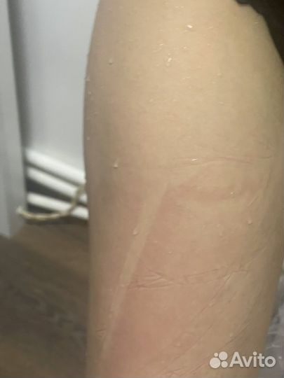 Прессотерапия Лимфодренажный массаж