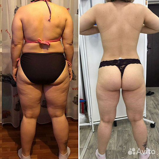 FlaxBody трёх этапная Антицеллюлитная система обер