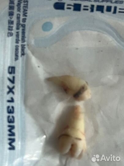 Зуб мудрости