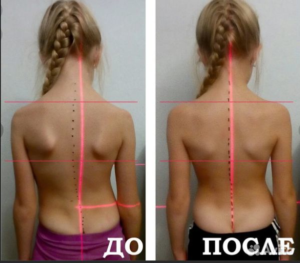 Ровная спина