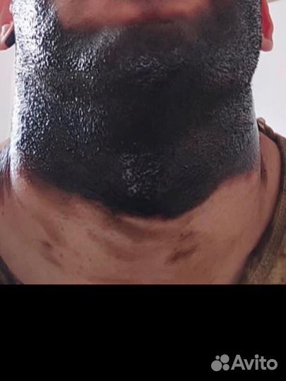 Мазь нафталновая+вода сероедная