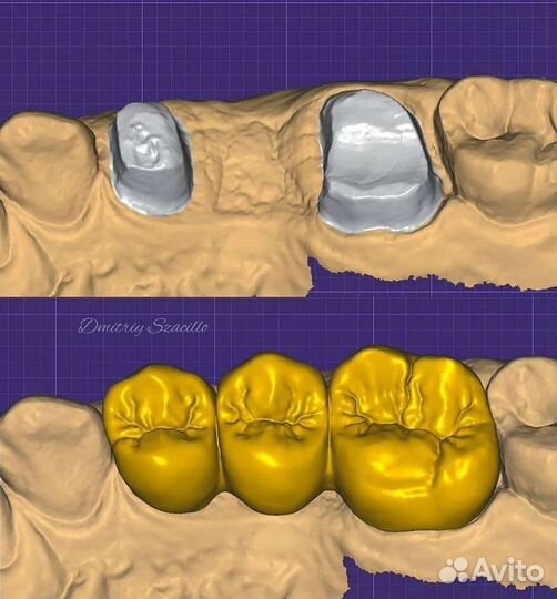 Зубной техник