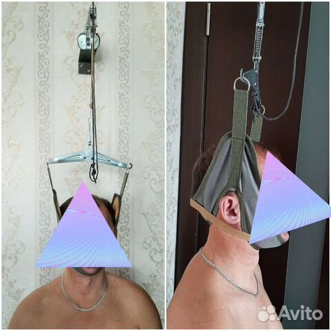 Петля Глиссона