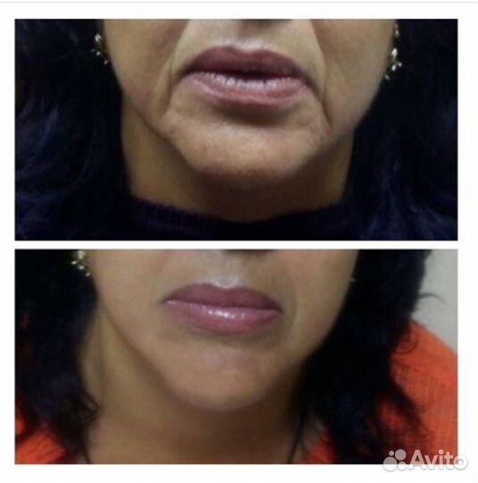 Массаж лица и тела, косметолог