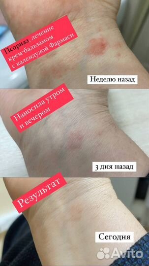 Крем бальзам с маслом календулы