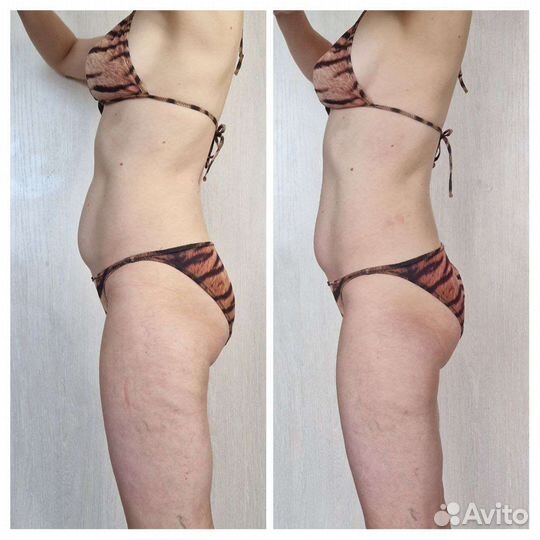 Похудение вместе, Красота и здоровье