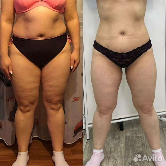 FlaxBody трёх этапная Антицеллюлитная система обер