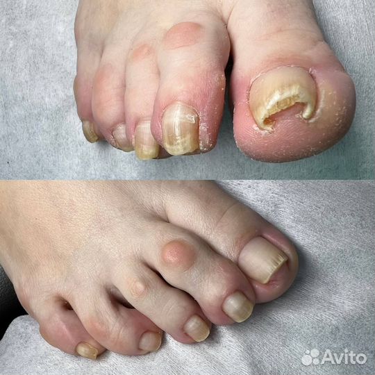 Подолог с выездом на дом