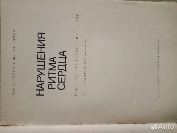 Нарушения ритма сердца