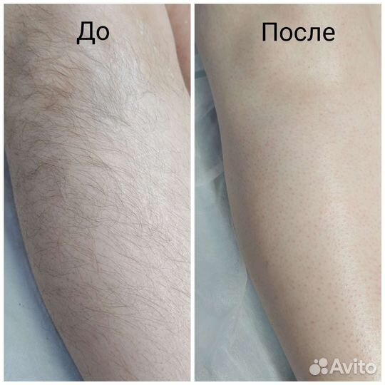 Шугаринг, Воск, Ароматическая SPA-депиция