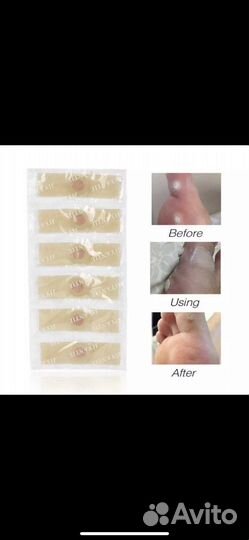 Пластырь от стержневых мозолей