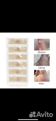 Пластырь от стержневых мозолей