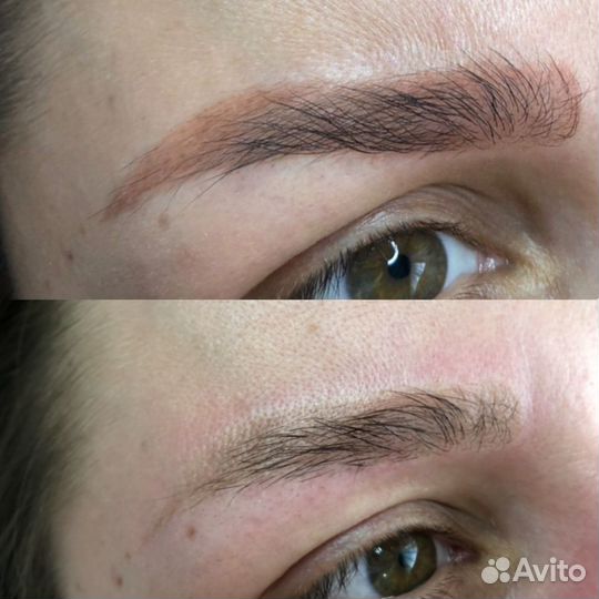 Удаление тату/татуажа