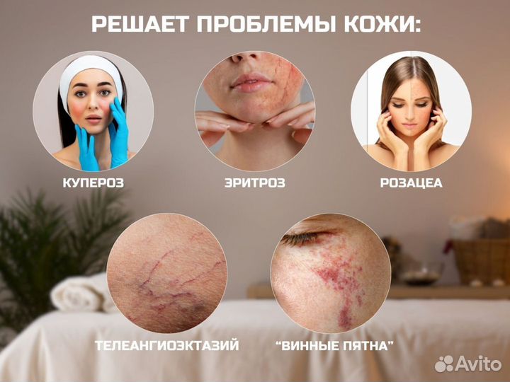 Васкулярный лазер для удаления сосудов