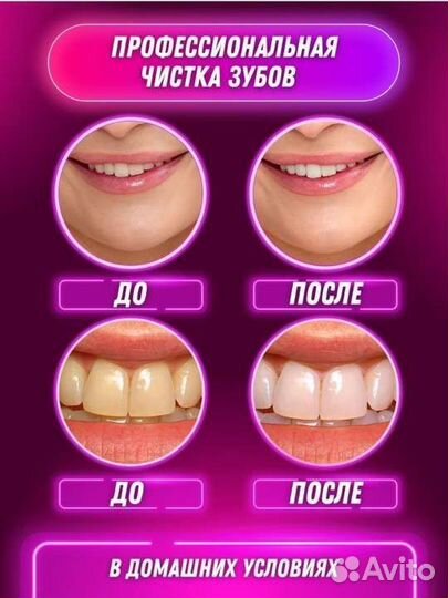 Скалер для зубов Dreams Beauty