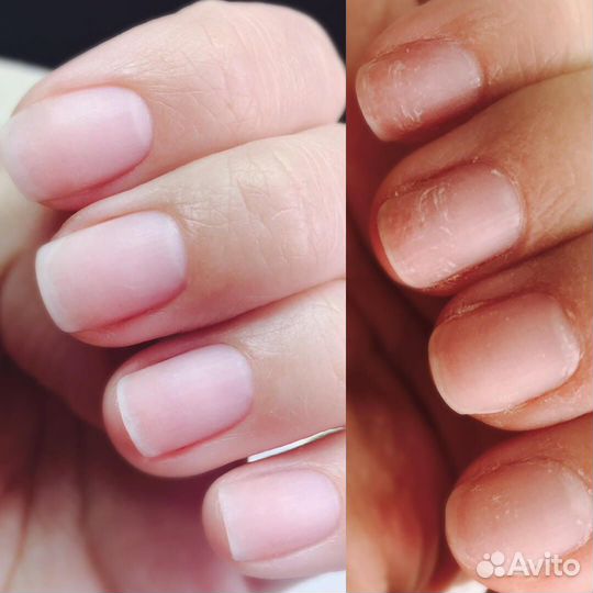 Маникюр, педикюр, наращивание