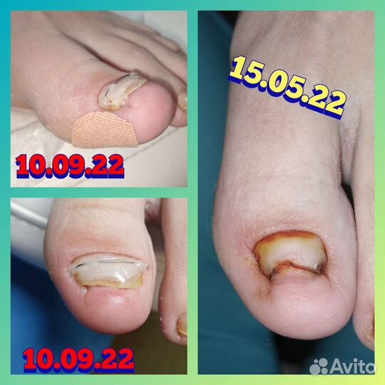 Подолог с медицинским образованием Девяткино