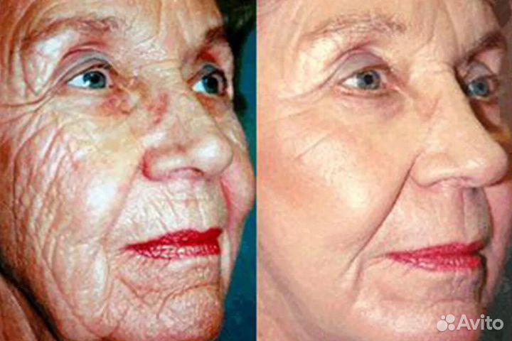 Массаж лица