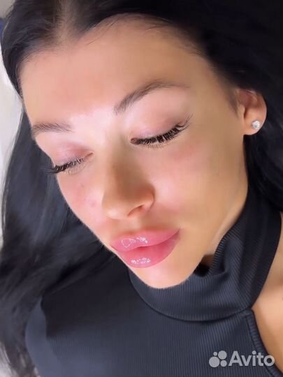 Косметолог увеличение губ ботокс био