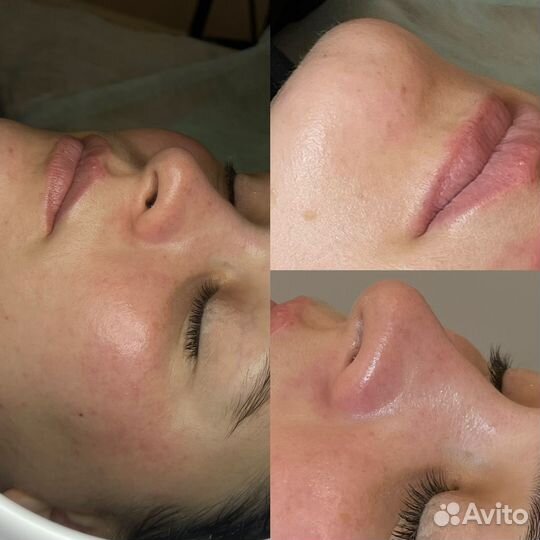 Услуги косметолога full face
