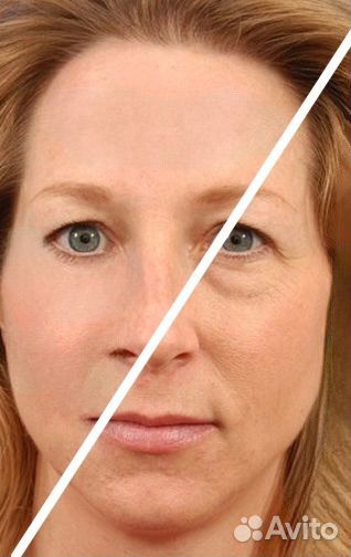 Обработка фотографий ретушь фотошоп