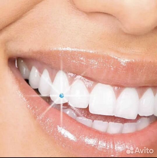 Установка скайсов