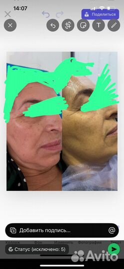 Холодная плазма