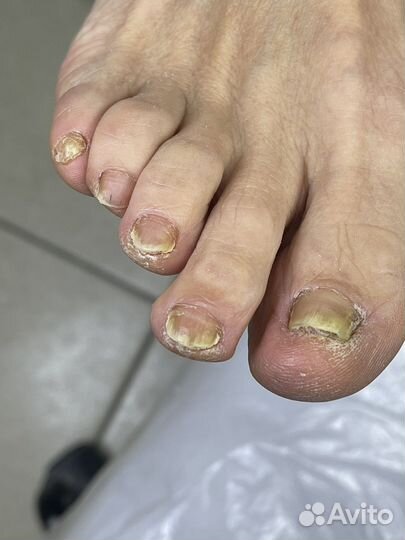 Педикюр серпухов