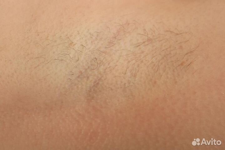 Шугаринг: бёдра