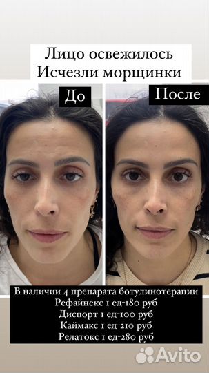 Косметология, лазерная эпиляция, трихопигментация