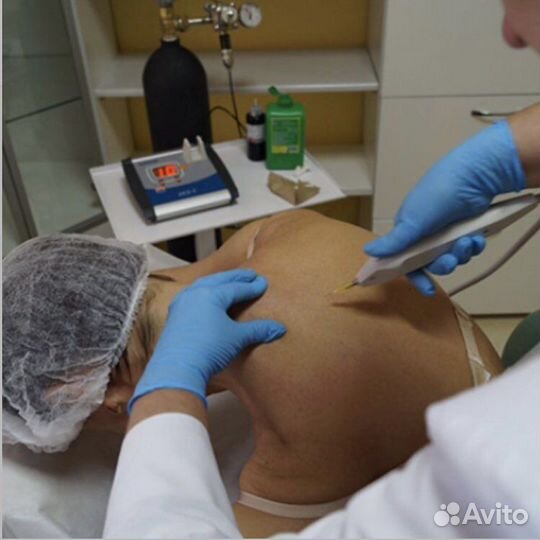 Карбокситерапия