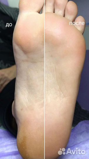 Детский маникюр