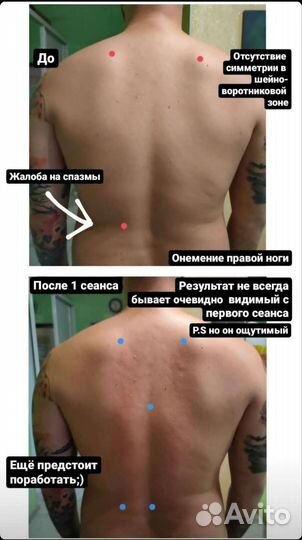 Лечебный массаж