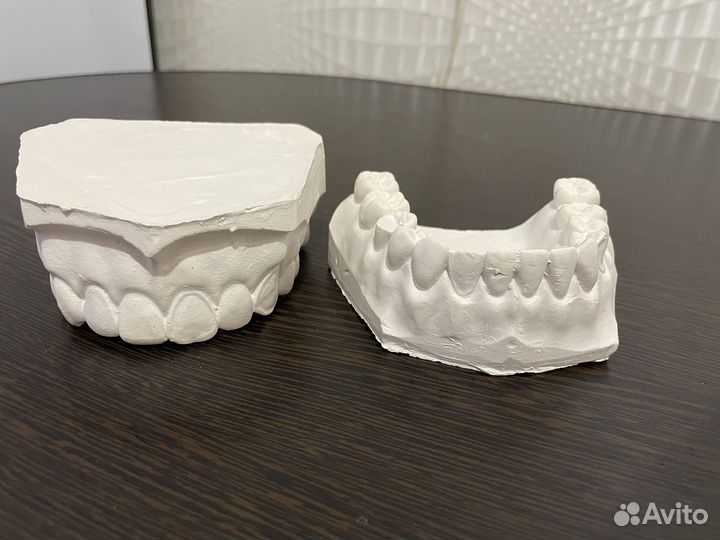 Гипсовые челюсти