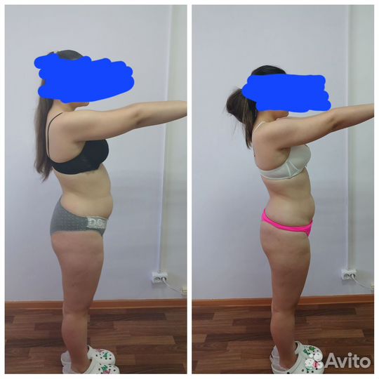 Аппаратный антицеллюлитный массаж. LPG