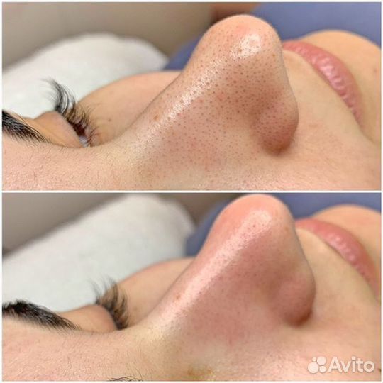 Косметолог - Эстет