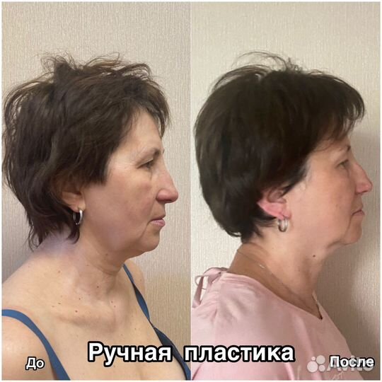 Обучение курсы массажа