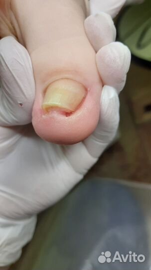 Мужской педикюр