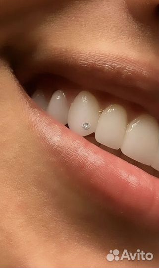 Установка скайсов