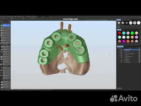 3Diagnosys + Plastycad