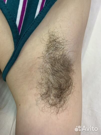 Шугаринг, восковая депиляция, эпиляция