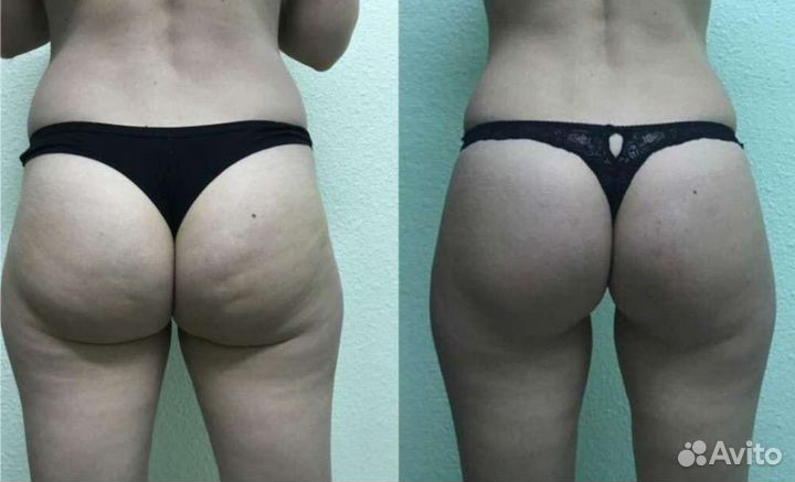 Спа-процедуры