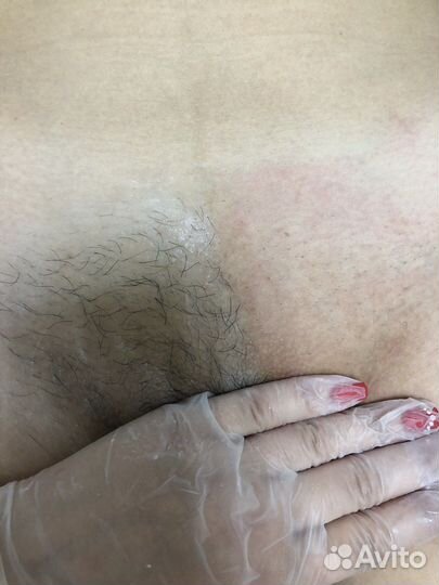 Шугаринг быстро и без боли