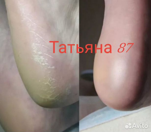 Приглашаю всех на маникюр, педикюр