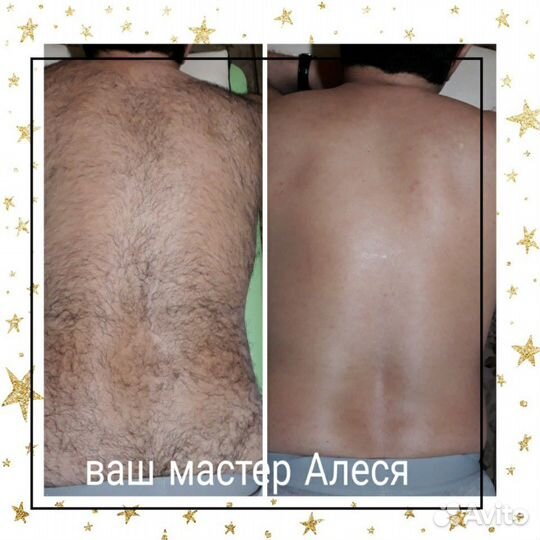 Депиляция Шугаринг,S'kins (мужской/женский) Реутов