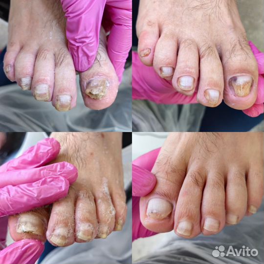 Педикюр с выездом на дом