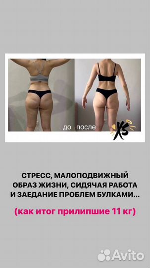 Антицеллюлитный массаж ручной