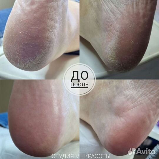 Маникюр, педикюр, ресницы, массаж